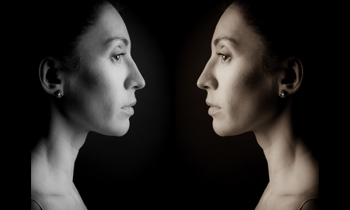 The Right for “Entweder-Oder”