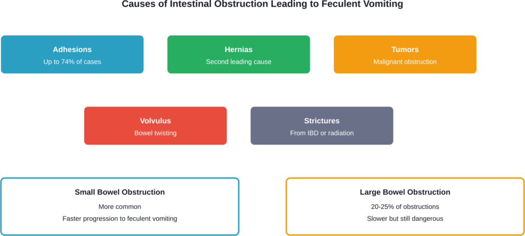 Distribution of intestinal obstruction causes that can lead to feculent vomiting, based on NIH clinical data