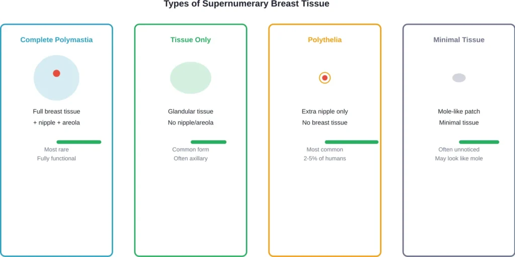 Classification of supernumerary breast tissue from complete polymastia to minimal tissue presentations