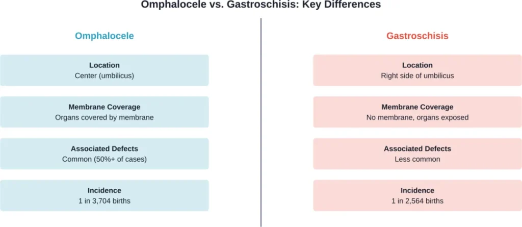 Comparison of omphalocele and gastroschisis, the two primary birth defects that can result in babies born without belly buttons.