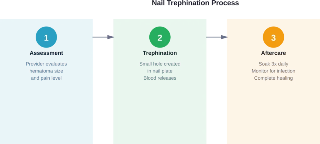 Three-step process of professional nail trephination for subungual hematoma treatment