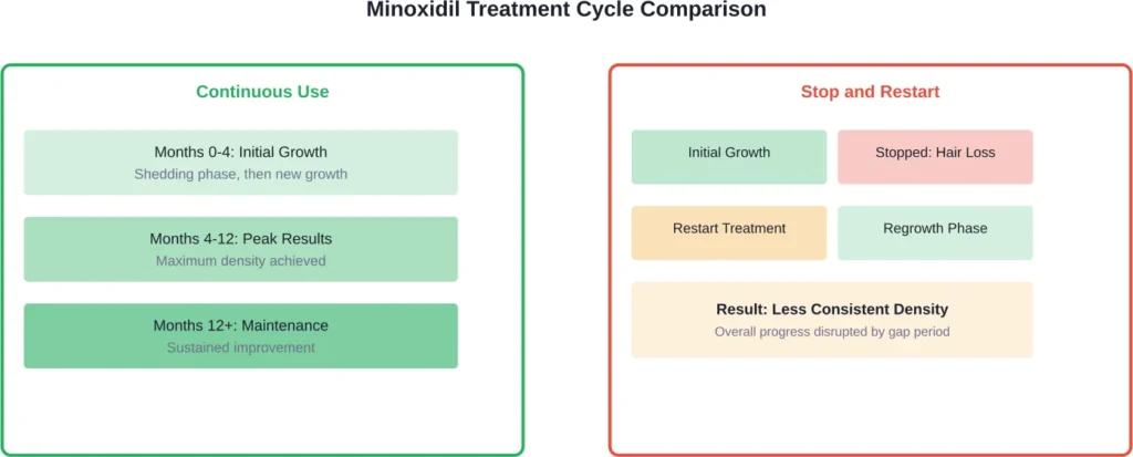 Comparison showing how continuous minoxidil use maintains steady results versus the setbacks created by stopping and restarting treatment.
