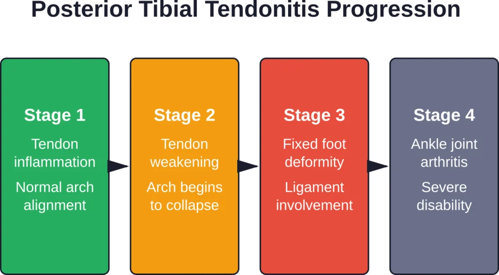 The four stages of posterior tibial tendon deterioration, from early inflammation to severe structural changes requiring surgical intervention.
