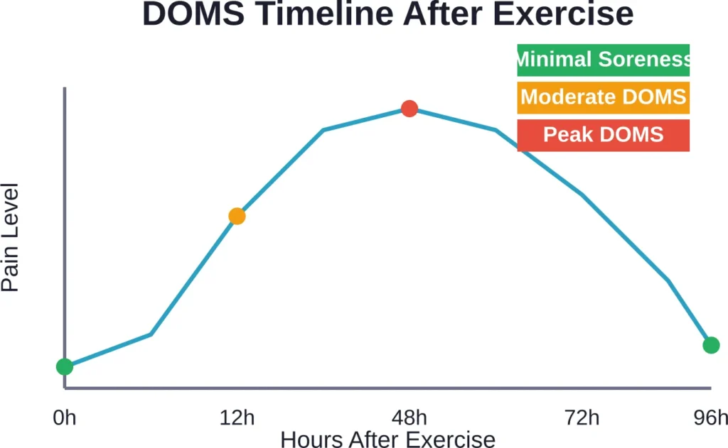 Delayed onset muscle soreness follows a predictable pattern, typically peaking 24-72 hours after exercise before gradually subsiding